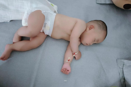 借卵生子机构宝宝脸上有白色斑块